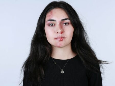 Yleiset baseball-vammat ja toipumisaikataulut